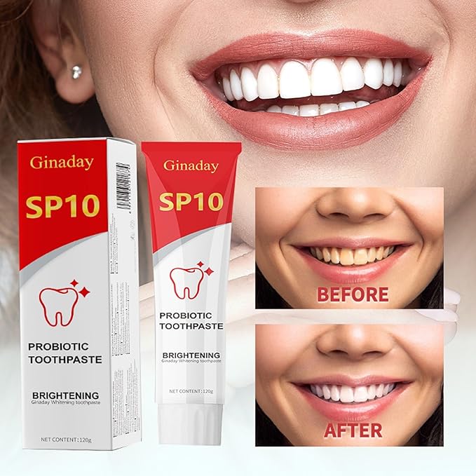 SP10 Probiotic Toothpaste, Deep Cleaning Care Fresh Breath Ultra Whitening SP10 Toothpaste.(1Pcs)