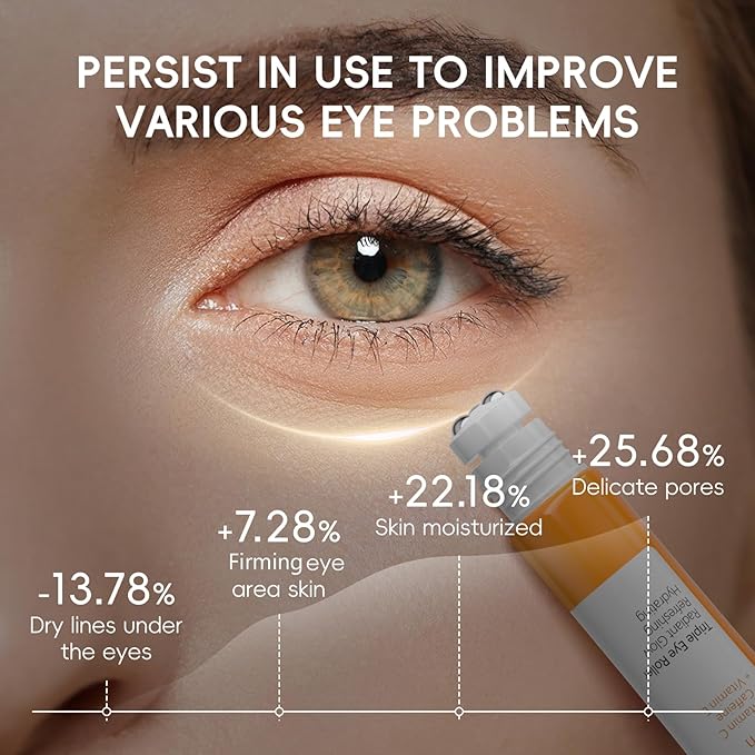 AKARY Vitamin C Eye Cream & Under Eye Serum, Refreshing, Hydrating, Radiant Glow Skin Roller Serum with 360° Massage Ball, Tightening for Women Reduce Wrinkles Fine Lines
