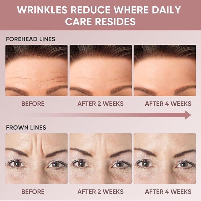 Forehead Wrinkle Patches | Reusable Overnight Smoothing Patches with Lavender Oil | Anti-Wrinkle Silicone Face Tape to Reduce Fine Lines, Prevent Creases | Non-Invasive Facial Pads | Pack of 4