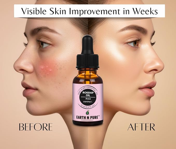 Earth N Pure Rosehip Seed Oil | 100% Pure Natural Cold Pressed Carrier Oil | Premium Quality for Face, Hair, Skin, Nails, Body Massage & DIY Beauty Care | Hexane Free | 50ml