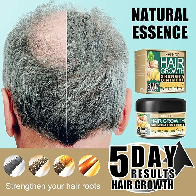 Ginger Hair Growth Cream, Germinal Conditioner, Regrowth Serum - Unisex, For Hair Loss and Thinning(30g/1 OZ sample)
