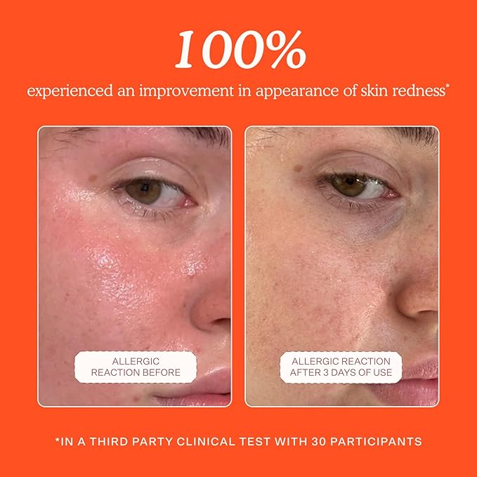 Tower 28 SOS Daily Rescue Facial Spray - Hypochlorous Acid Spray to Help Reduce Redness, Calm Irritation + Alleviate Flare-Ups - Purifying Face Toner Duo - Full + Travel Size Skin Care Spray (2 Count)