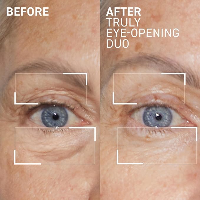 Dr. Brandt Truly Eye Opening Duo - Includes No More Baggage (0.5 oz) & 360° Firming Eye Cream (0.5 oz)