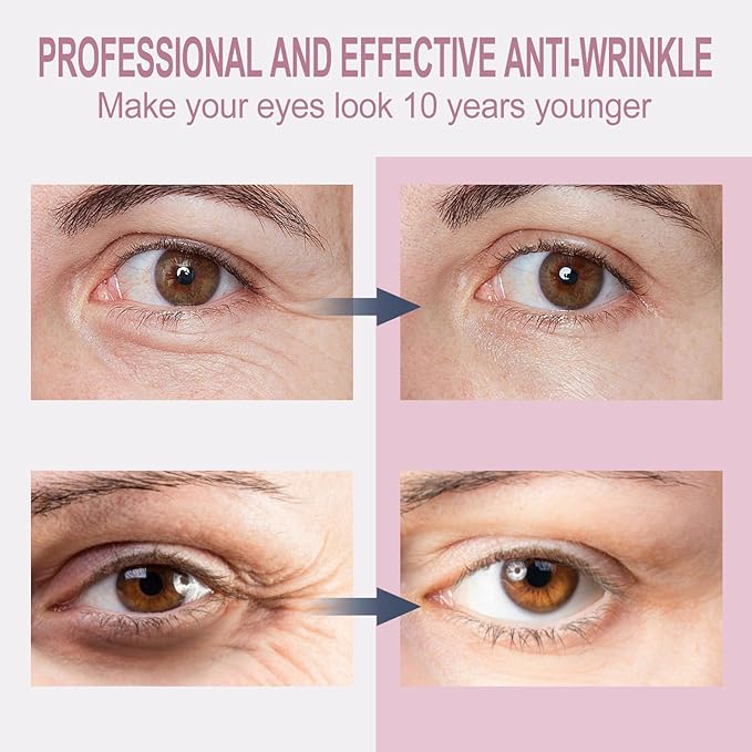 Temporary Tightener Eye Cream-Instantly Reduces Under- Bags, Dark Circles & Wrinkles, Anti-Aging with Retinol&Hyaluronic Acid, Under Eye Creams Suit Women Men Firm Smooth firming Non-Greasy- corrector