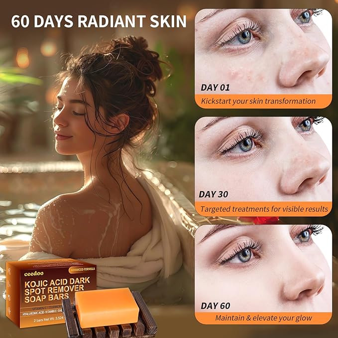 Kojic Acid Dark Spot Remover Soap Bars with Vitamin C, Retinol, Collagen, Turmeric with Hyaluronic Acid, Vitamin E, Shea Butter, Castile Olive Oil - 3.52 OZ x 2 Bars