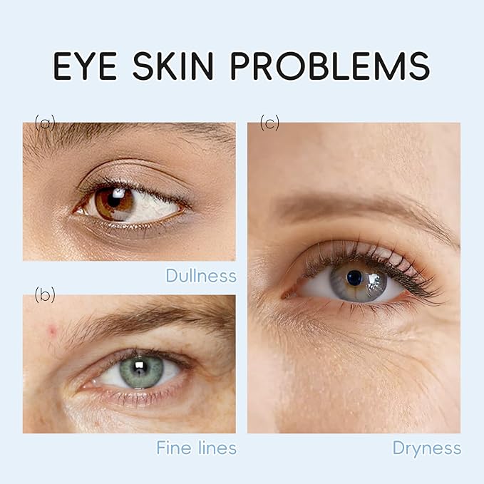 AKARY Milk Under Eye Patches 60PCS, for Dullness, Fine Lines & Dryness, Hydrating Eye Pads with Hyaluronic Acid, Firming & Nourishing, Enhance Elasticity, Radiant Glow, Mask Skincare for Women & Men