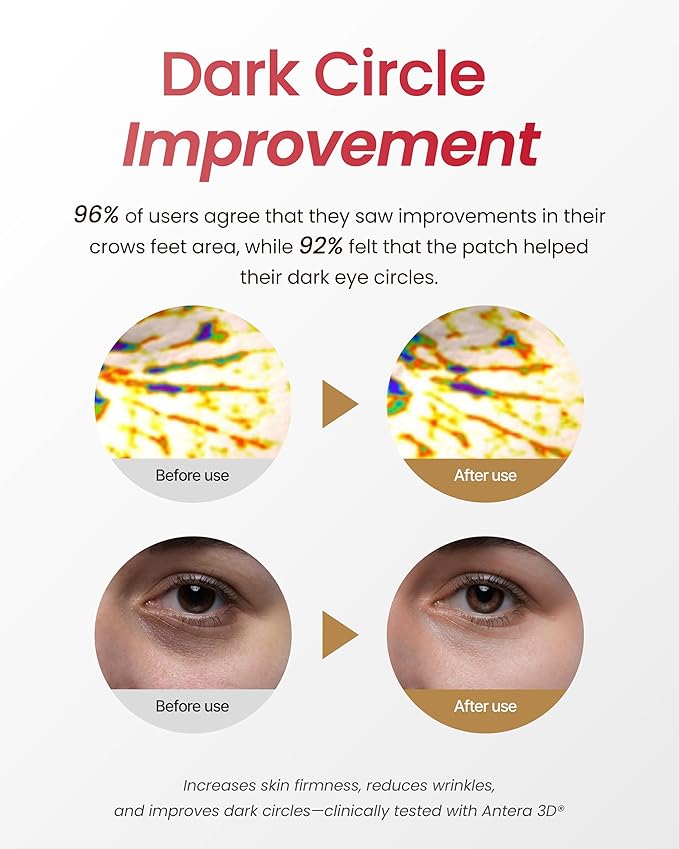 YADAH Red Food Energy Eye Patch 60 Pairs - Hydrogel Under Eye Mask with Pomegranate & Ginseng for Firming, Hydration & Puffiness Reduction.