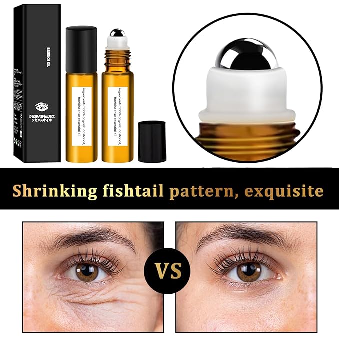 Roller Ball Castor Oil Applicator, Castor Oil Frankincense Rollerball, Rollerball Castor Oil for Eyes, Dark Circles, Puffiness, and Fine Lines
