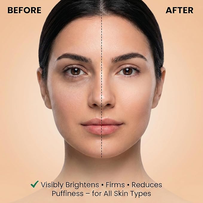 Nourishing Miracle Under Eye Cream – Treats Dark Circle & Fine Lines, Firms, Brightens & Hydrates Around Eye Area, Anti Aging Eye Cream with LARVOGEN™ Bio Oil Peptides & Jojoba Oil, 30g
