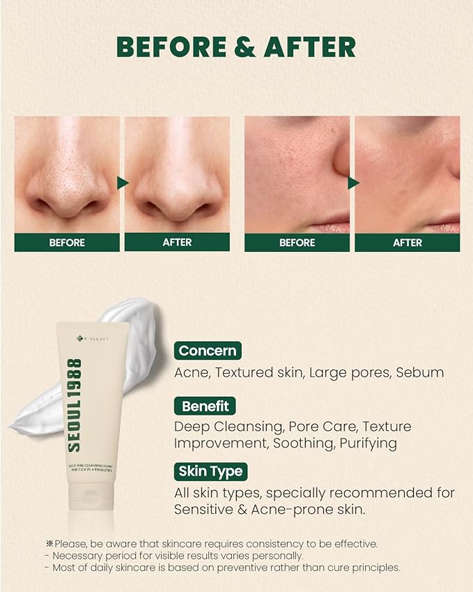 K-SECRET SEOUL 1988 Cica Cleansing Foam – Deep Pore Cleansing & Soothing Care | Daily Facial Cleanser for Sensitive Skin | Korean Skincare, 150ml / 5.07 fl oz