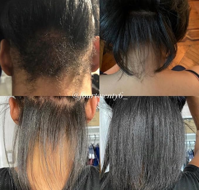 Hair Growth Oil with Rare Batana & Ayurvedic Herbs - Extra Strength Natural Treatment for Thinning Hair Loss, Edges, Scalp Health - Strengthens & Thickens All Hair Types - 30+ Botanicals - 2oz