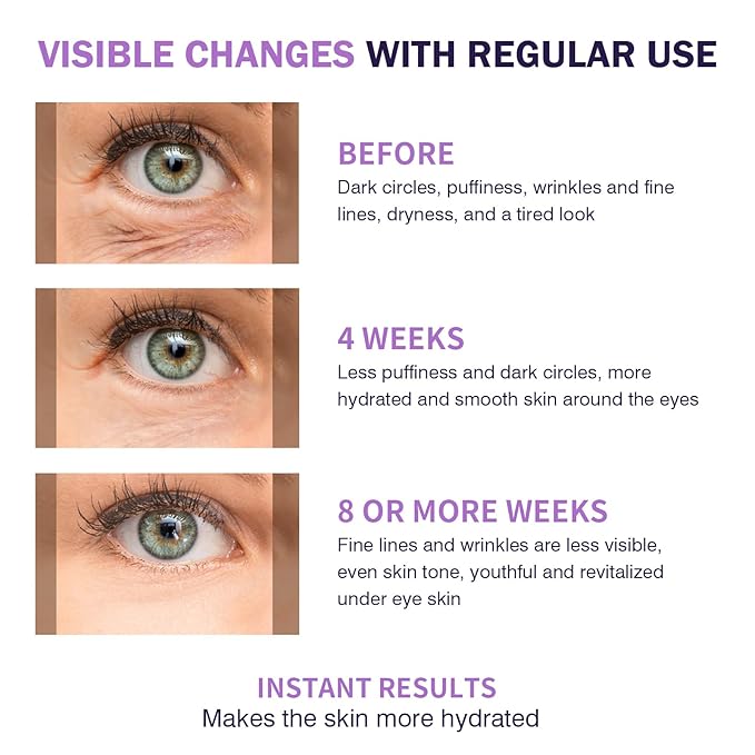 Eye Serum with 5% Mate Caffeine, Under Eye Cream for Puffy Bags Fine Lines Dark Circles Wrinkles, 360° Roller Massage Ball Eyes Treatment Serum Brightens Tired Eyes 5ml 0.5 fl. oz