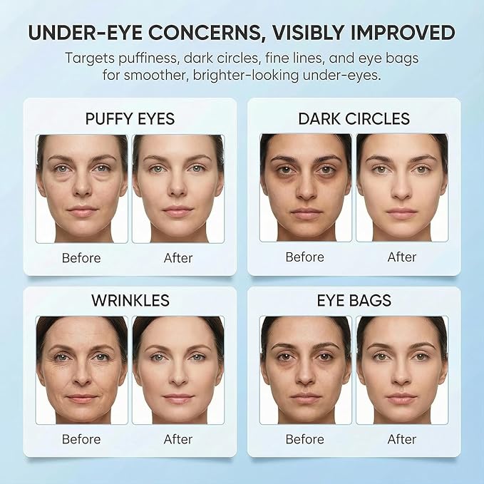 Bio-Collagen Eye Patches – 30 Pairs丨Under Eye Patches for Dark Circles, Puffiness, Fine Lines丨With Collagen, Hyaluronic Acid, Niacinamide丨Hydrating, Anti-Aging丨Korean Skincare