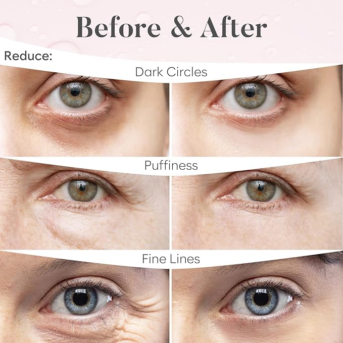 BLOOMORA Rose Under Eye Patches (30 Pairs) - Under Eye Mask for Appearance of Dark Circles - For Puffy Eyes Smoothing - Skincare Mask