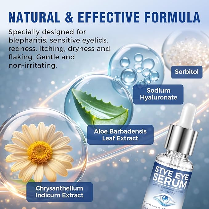 Stye Eye Treatment, Natural Relief Serum for Styes, Chalazions and Blepharitis, Blepharitis Treatment for Eyelids, Quickly Relieves Eyelid Irritation and Restores Healthier Skin, 30ML