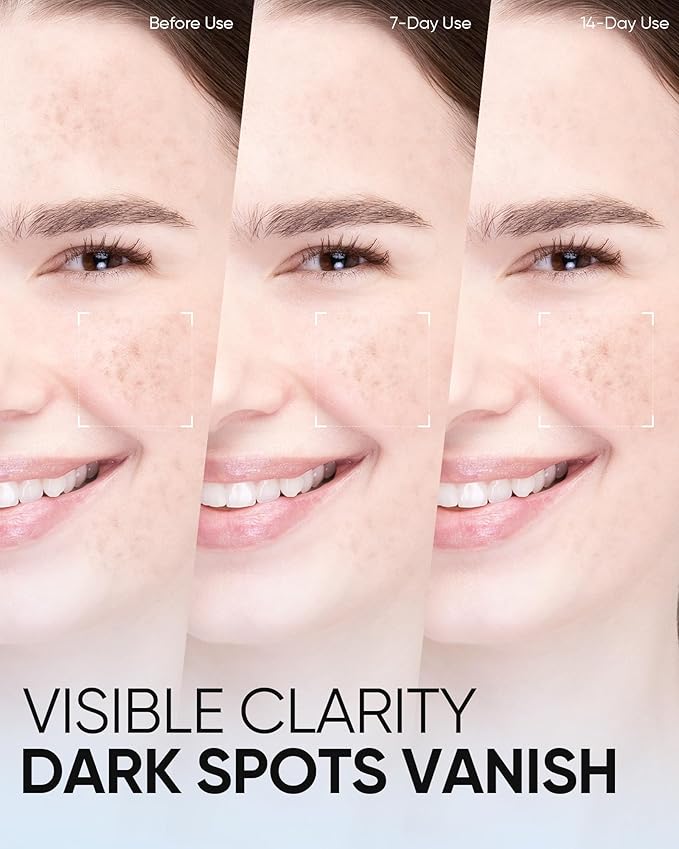 Brightening Serum Toner with 377 Pro Optical Scattering Technology – Hydrating, Lightens Dark Spots, Evens Skin Tone – Tamarind Seed Polysaccharide & Arginine for Radiant, Healthy Skin