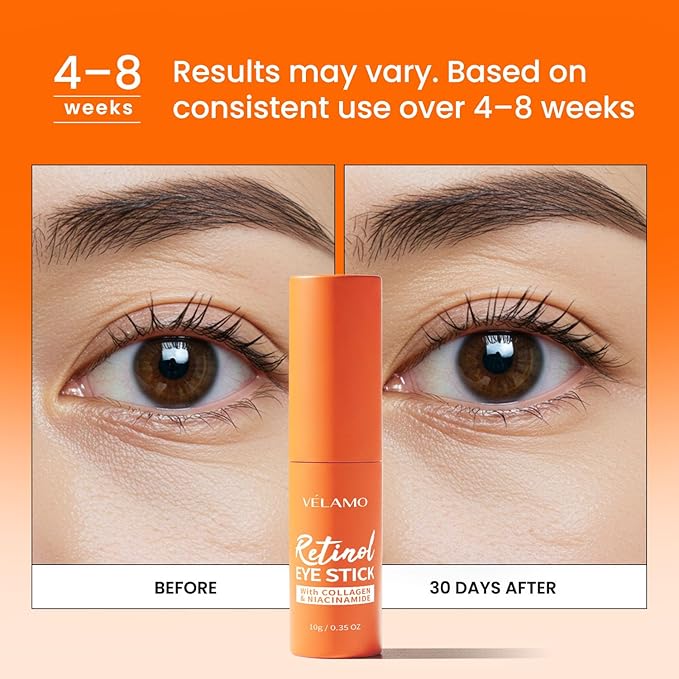 Retinol Caffeine Eye Balm Duo: Korean Under Eye Cream for Dark Circles, Puffiness, Eye Bags, Wrinkles & Fine Lines - 8-IN-1 Formula with Collagen, Niacinamide, Peptides & Hyaluronic Acid 0.45 OZ/13g