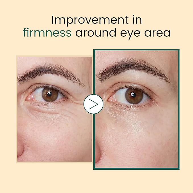 Instant Eye Tightener Puffy Eyes Roller Serum with Salmon DNA PDRN Peptides and Niacinamide Dark Circle, Under Eye Bags, Wrinkle Treatment Cream Eye Serum for Depuffing Firming Anti-Aging, 0.5 fl.oz