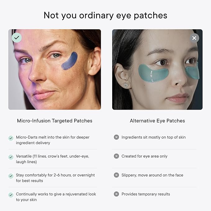 Qure Micro-Infusion Anti Wrinkle Patches for Smile Line, Frown lines, Under Eye Bags, Puffiness, Crow's Feet - Retinol, Caffeine, Niacinamide & Peptides - Dissolvable for Overnight Use - 16 Pairs