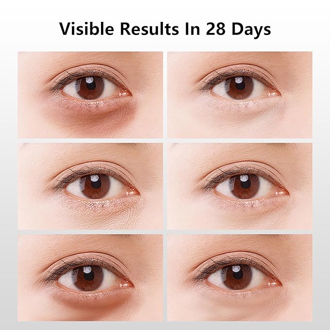 Salmon DNA PDRN Eye Patches for Dark Circles & Puffiness 50 Patches Collagen Multi Peptide Under Eye Masks for Wrinkles Hydrating 360° Eye Treatment Pads, Anti-Aging Travel Skincare for Women