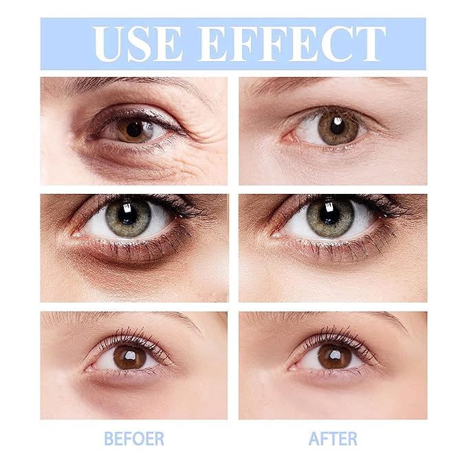 Retinol Firming Eye Serum, Hydrating Eye Cream for Instantly Minimizes Puffiness, Anti-Aging Treatment with Retinol & Peptides Fast-Absorbing for Women & Men
