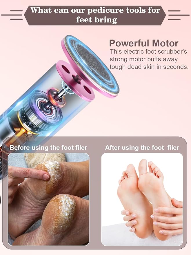 Electric Foot Callus Remover for Feet - Heavy Duty Pedicure Tool w/ 60 Grinding Discs Dead Skin Remover (Pink)