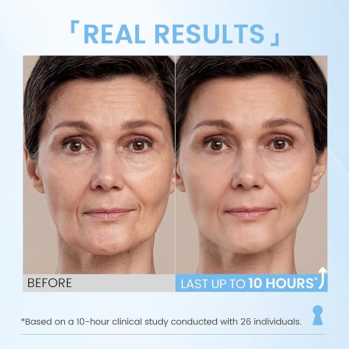 RONKIE Instant Eye Lift Cream: Reduces Eye Bags Wrinkles Puffy Eyes Dark Circles Crow’s Feet in Minutes for Mature Skin of Middle-aged Women 1 Fl Oz (Light)