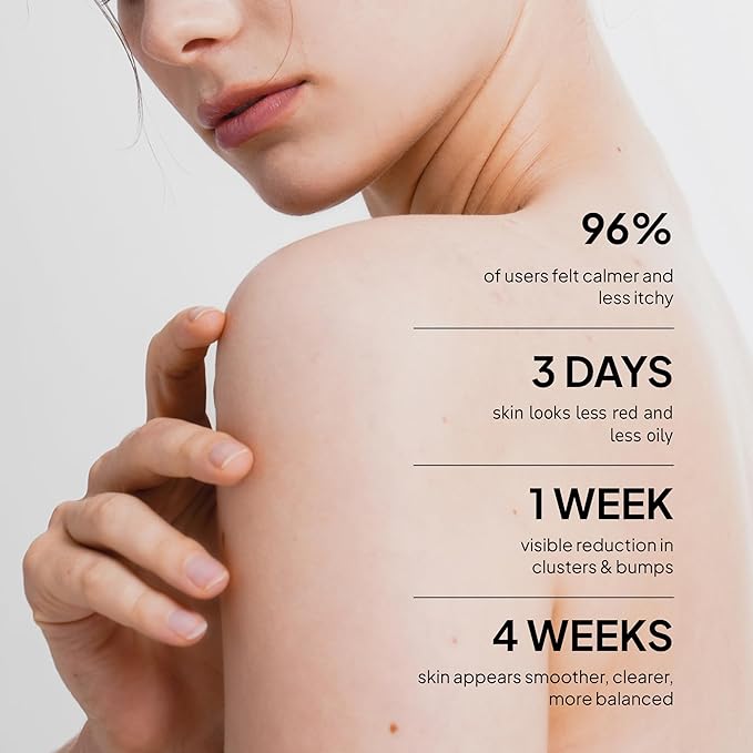 BellamiLuxx Fungal Acne Care 2-Step Routine: Helps with Bumps, Clusters, Itch & Redness – Body Acne Scrub + Lightweight Anti-Fungal Face & Body Lotion for Fungal Skin with Natural Actives
