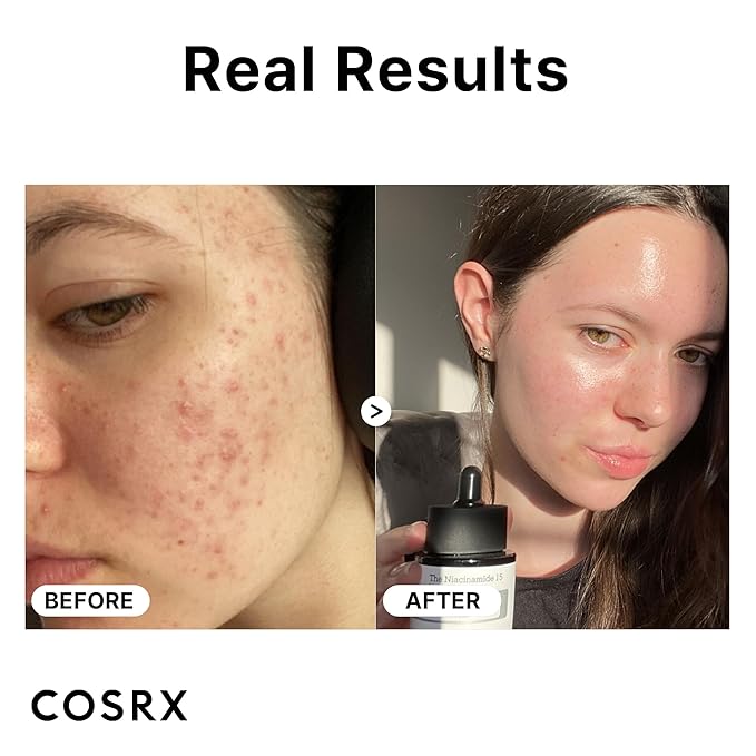 COSRX Skin Repair Set - Niacinamide 15% Serum + Snail Mucin 96% Essence, Hydrating and Pore Minimizer Serum for Glowy Skin