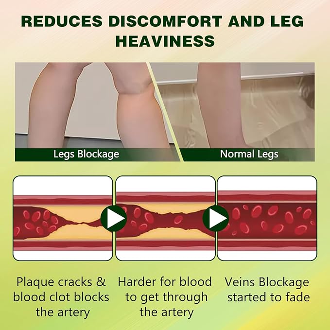 FluidEase Leg Therapy Edema Cream, Edema Relief for Legs and Feet, Natural Comprehensive Care Herbal Massage Cream for All Skin Types