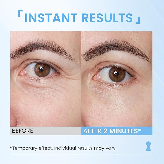 Instant Eye Lift Cream: Reduces Eye Bags Wrinkles Puffy Eyes Dark Circles Crow’s Feet in Minutes for Mature Skin of Middle-aged Women 1 Fl Oz
