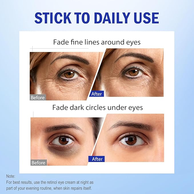 Retinol Eye Cream, Hydrating Under Eye Care Daily Wrinkle Cream, Infused with AHA30% to Smooth and Hydrate Skin, Eye Crea for Dark Circles Treatments, Reduce Under Eye Bags, Smooth Wrinkles, 3Pack