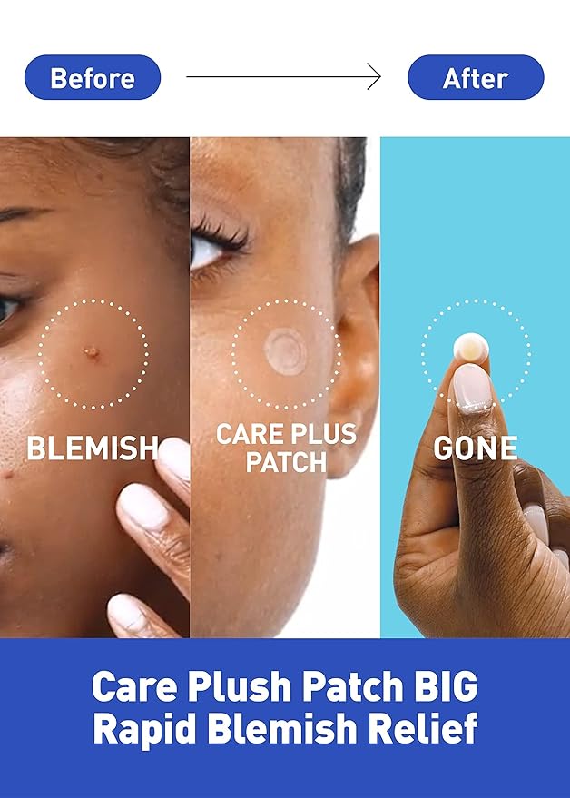 OLIVE YOUNG Care Plus Spot Patch | Hydrocolloid Acne Korean Spot Patch to Cover Zits, Pimples and Blemishes, for Troubled Skin and Face (510 count (Pack of 5))