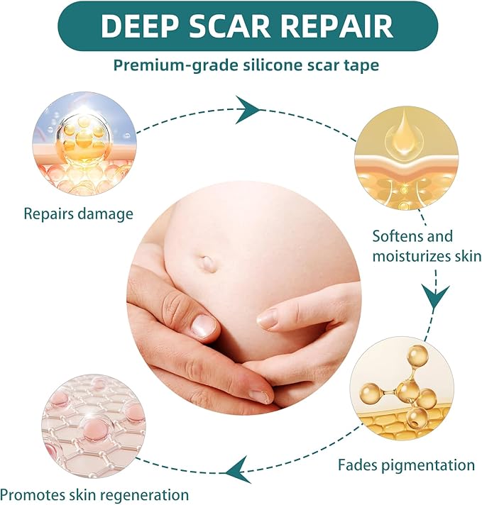 Silicone Scar Tape for Surgical Scars: Medical Grade Scar Gel Sheets for C-Section Tummy Tuck Recovery and Treatment – Reusable Scar Strips for Keloid Burn Acne Scars Removal (1.6'' x 60''Roll-1.5M)