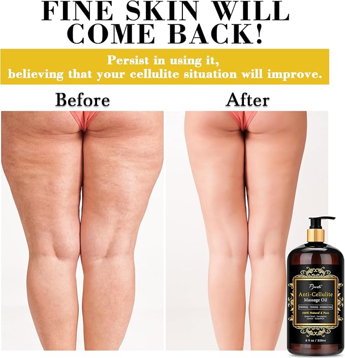 Pjordo Anti Cellulite Massage Oil with Massager, Collagen and Stem Cell Skin Tightening Oil Natural Cellulite Remover Therapy Oil for Cellulite & Stretch Mark(Anti Cellulite Massage Oil Kit)