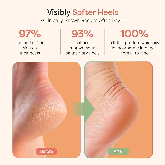 ZenToes Moisturizing Socks for Cracked Heel Treatment, Vitamin E, Olive Oil and Jojoba Oil Heel Socks, Stocking Stuffers for Women, Spa Self Care Gifts for Women (Fuzzy Pink, Regular)