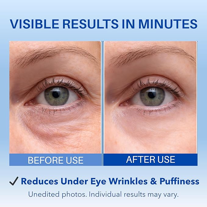 Instant Under Eye Tightening Serum – Firming Eye Lift Formula for Bags, Puffiness, Wrinkles & Dark Circles | Advanced Polysaccharide Eye Serum for Mature Skin – 20 mL (Unscented)