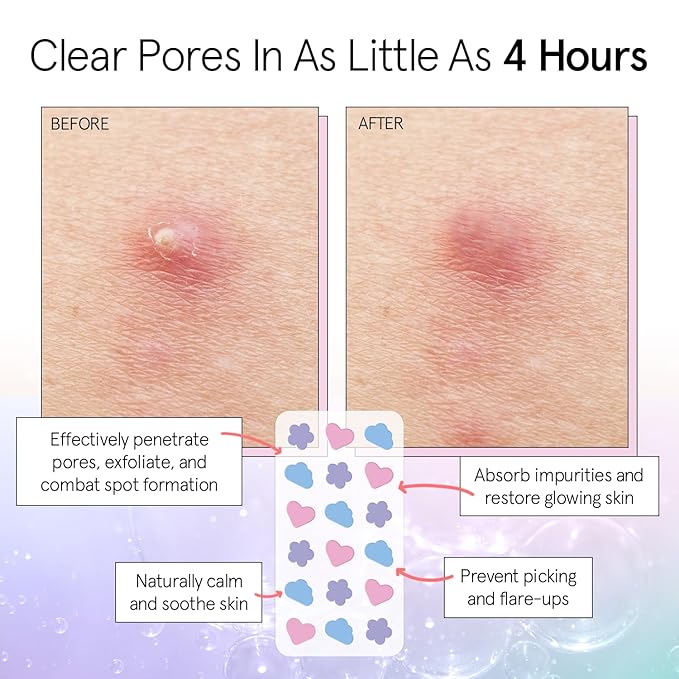 grace & stella Award Winning Pore Strip - Pimple Patches for Face - Hydrocolloid Acne Patches - Absorbs Zits, Reduces Redness - Cute Patches Dermatologist-Tested, Vegan (Multishape, 36 Count)
