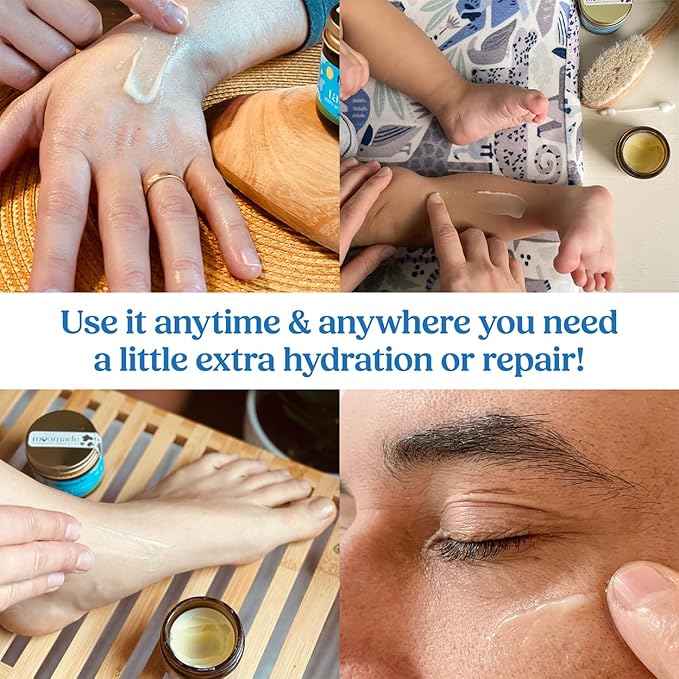 Organic Beef Tallow Bag Balm with Rosehip Oil | Unscented 1 oz – Hand Made in USA 100% Grass-Fed Beef Tallow Moisturizer for Face & Body, Baby, Eczema, Acne-Prone & Sensitive Skin