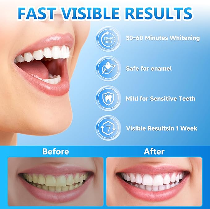 Milumber Teeth Whitening Strips for Sensitive, 28 Strips Whitener Safe Whitestrip, Deep Stains Removal Tooth Whitening, Enamel Safe Non-Slip Dry Strip Technology for Whiter Teeth, Mint
