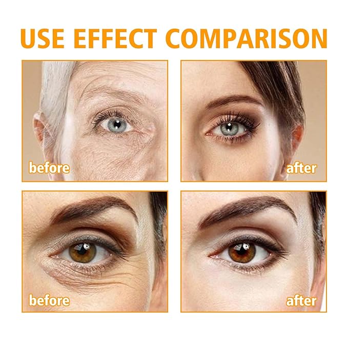 5D Peptide Eye Cream, Anti-Aging Eye Repair Cream for Dark Circles & Puffiness, Daily Wrinkle Reduction, Lightweight Under Eye Moisturizer with Vitamin E