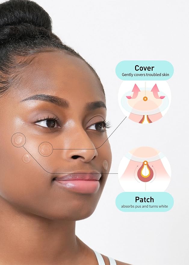 OLIVE YOUNG Care Plus Spot Patch | Hydrocolloid Acne Korean Spot Patch to Cover Zits, Pimples and Blemishes, for Troubled Skin and Face (510 count (Pack of 5))