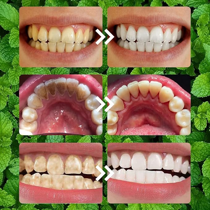 Teeth Restoration Mineral Powder, Teeth Whitening Mineral Powder 50g，Effective in StrengtheningTeeth and Gums, Fresh Breath (1 Bottle)