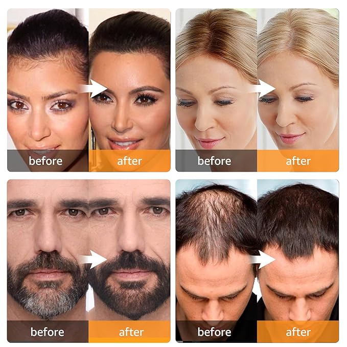 Root Touch Up Instantly Gray Coverage Hairline Powder, Conceal Hair Loss and Thinning For Women Men, Hair Fibers (Auburn)