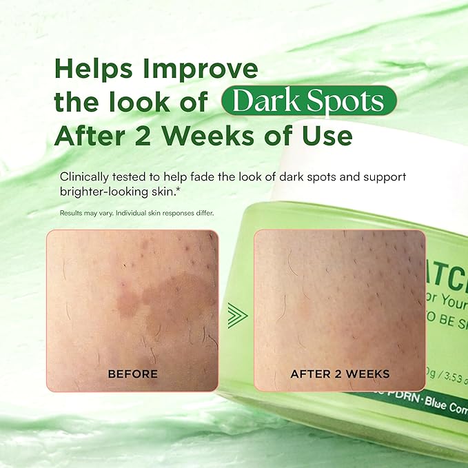 Matcha Facial Moisturizer with Rose PDRN, Korean Peptides Hydrating Firming Cream for Anti Aging, Dark Spot & Uneven Skin Tone, Soothing Radiance for Soft, Glowy Skin, All Skin Types, 3.53 oz