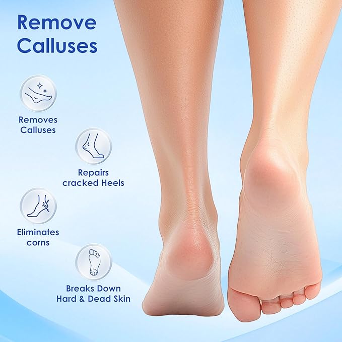 MOWLIE Professional Callus Remover for Feet – Extra Strength Foot Callus Remover Gel with 2 Glass Sandpaper Discs for Electric Foot Callus Remover,Foot Care kit - 50 ml/1.76 fl.oz