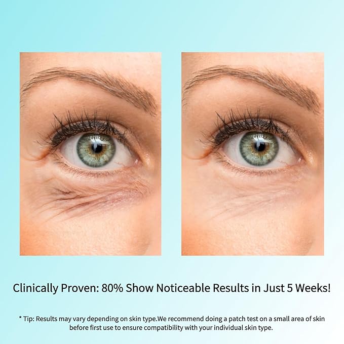 Retinol Eye Cream with Caffeine, Hyaluronic Acid & Vitamin C | Anti-Aging Under Eye Cream for Dark Circles, Wrinkles & Puffiness | Reduces Fine Lines Skin Care Treatment for Women & Men (15ml)