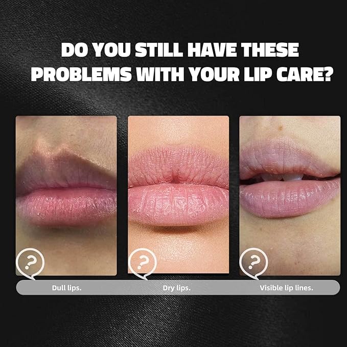 Lip Lightening Lip Balm for Dark Lips – Lip Softening & Hydration,Help Fade Dark Lip Discoloration, Moisturizing Lip Balm for Smokers,Reduces Discoloration & Fine Lines,for Men And Women