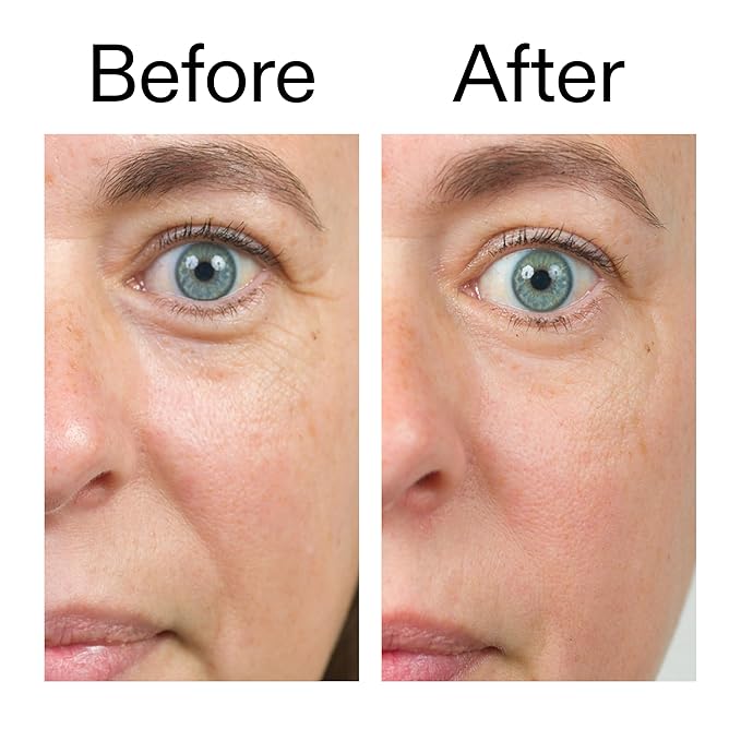 The INKEY List Bio-Active Ceramide Repairing and Plumping Moisturizer 1.7fl oz/50ml, Anti-Ageing Skincare, 24-Hour Hydration Cream, Vegan Friendly, Suitable For All Skin Types