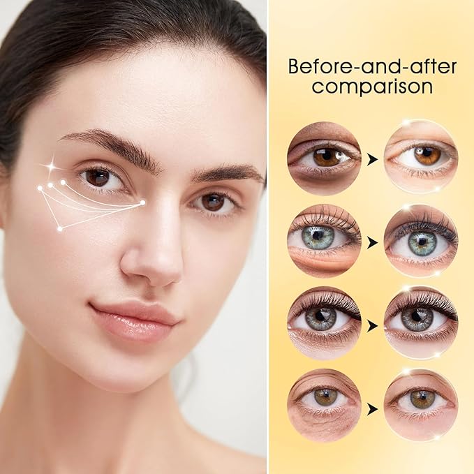 Adofect 30 Paris Under Eye Patches 24k Gold Under Eye Mask for Puffy Eyes and Dark Circles, Under Eye Bags Treatment Collagen Gel Pads for Beauty & Personal Care, Gold